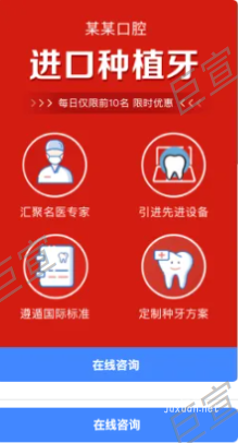 UC廣告錦帆智造組件介紹：咨詢組件